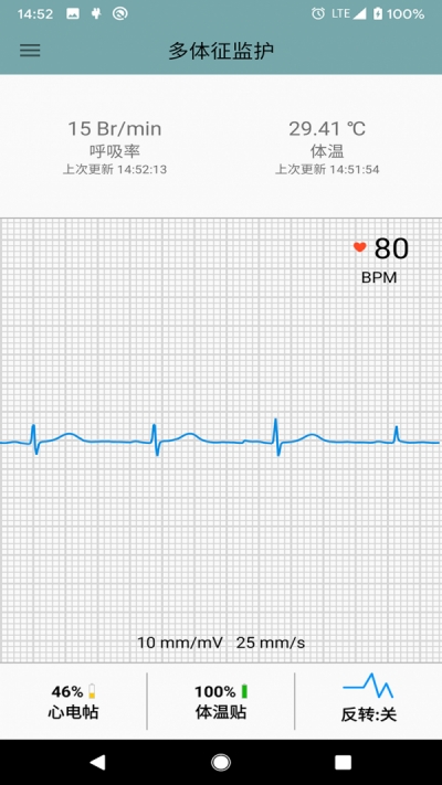 多体征监护app安卓版图2