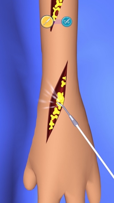 外科手术大师游戏手机版图1