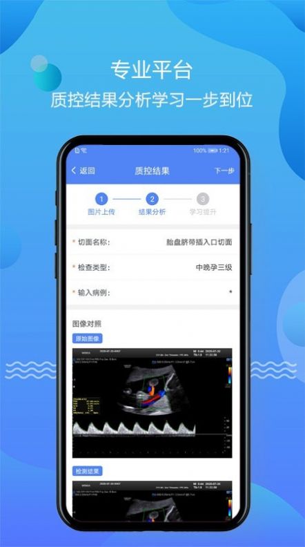 超声智库app图1