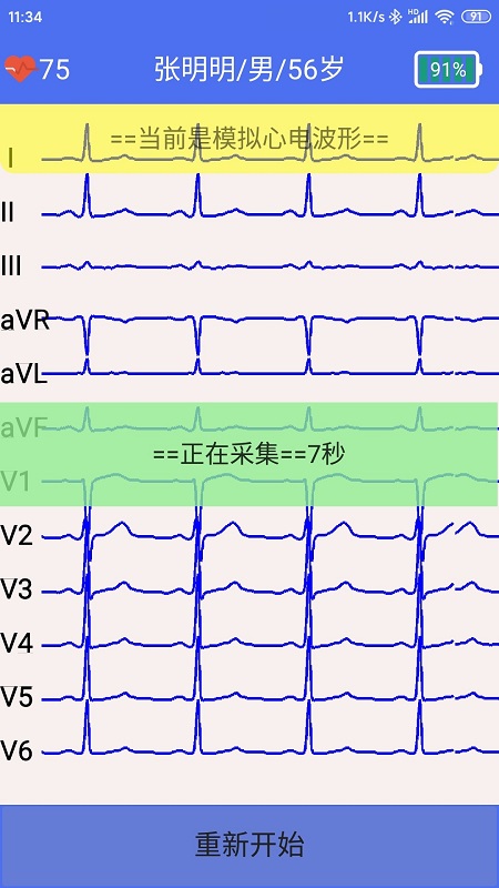 健康2030智能读图心电图系统图3