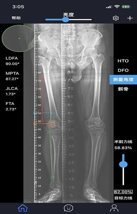 华保膝望app图片1