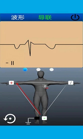 心电图计算器app官方版图1
