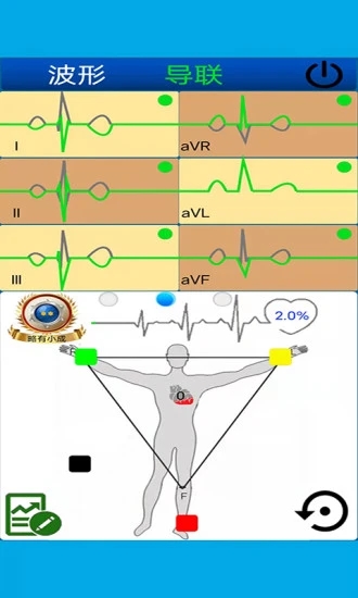 心电图计算器app官方版图3