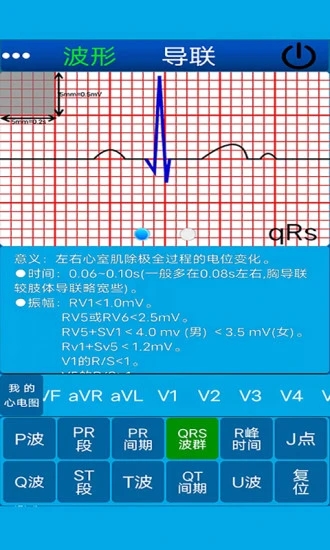 心电图计算器app图片1